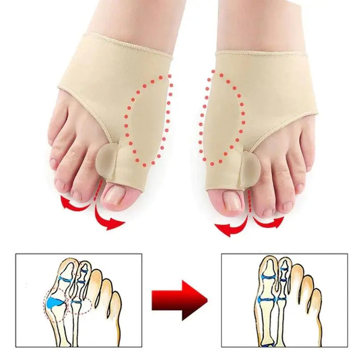 FootWell - Bunion Correction Sock