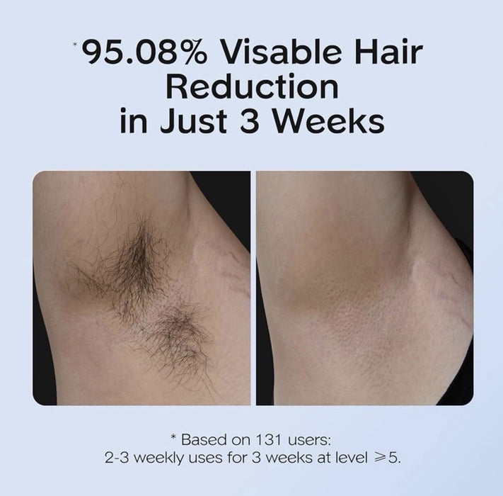 PetalSmooth - IPL Hair Removal Device