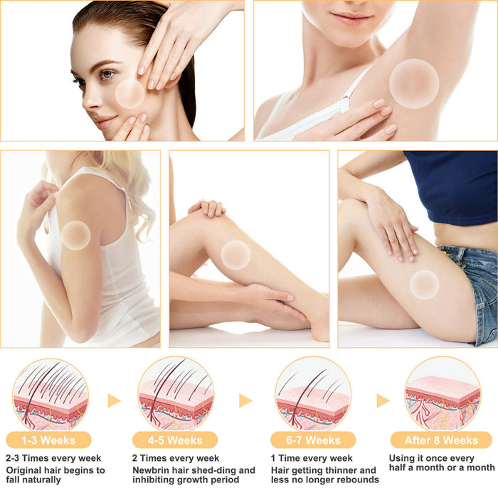 FlashSilk - Laser Hair Removal Device