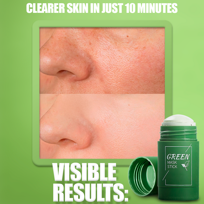 GreenMuse – Green Tea Face Mask for Blackheads