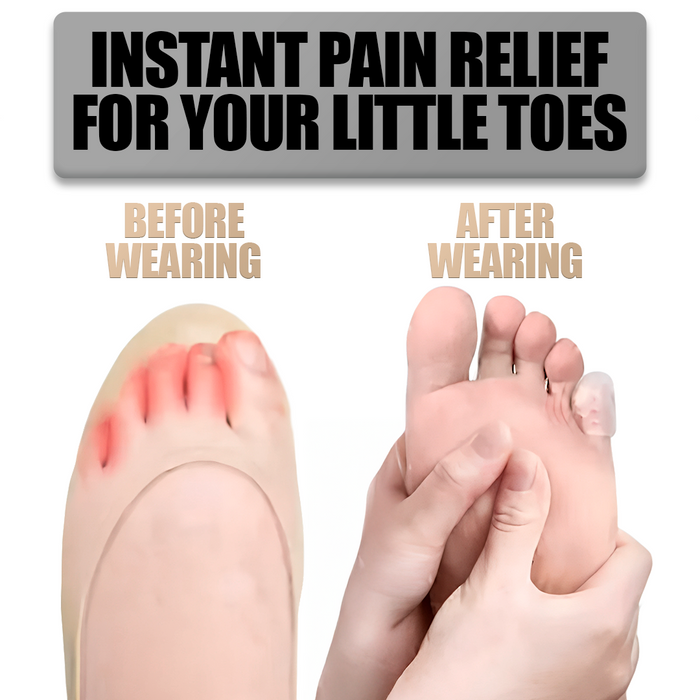 ToeBuddy Shield – Little Toe Protector for Corns and Blisters