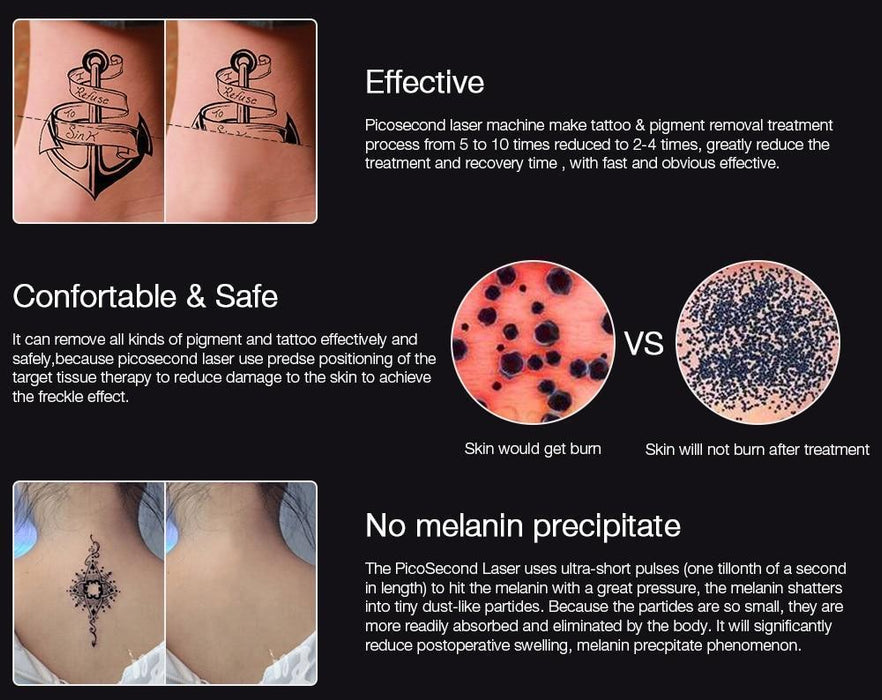 InkFade Pro - Laser Tattoo Removal Pen