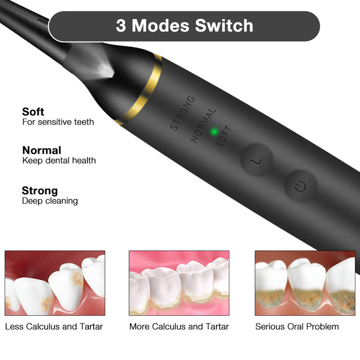 SparkleDent - High-Frequency Dental Cleaner