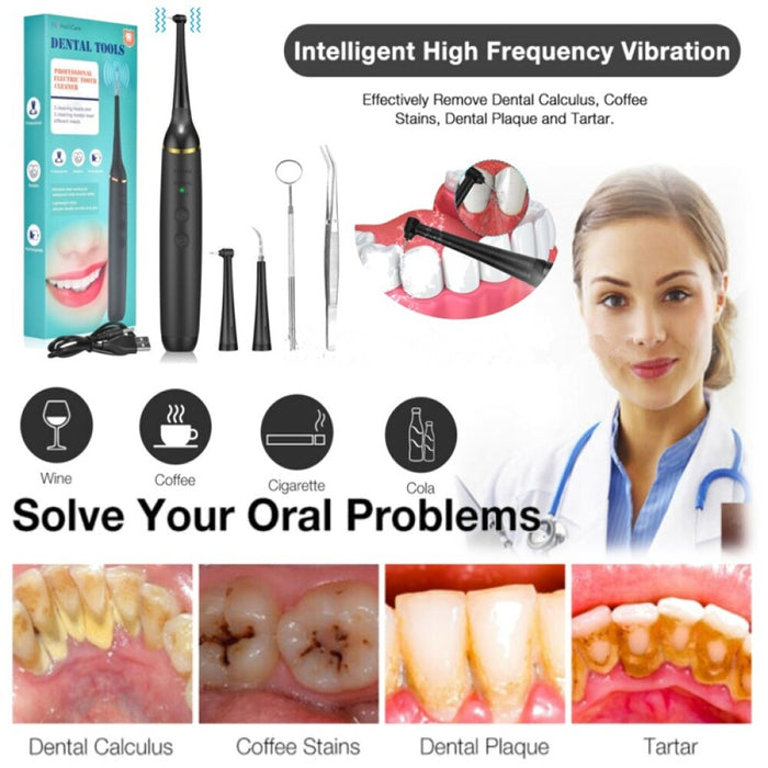 SparkleDent - High-Frequency Dental Cleaner