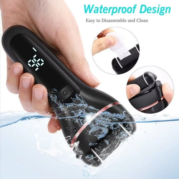 SoleSmooth - Electric Foot Callus Remover