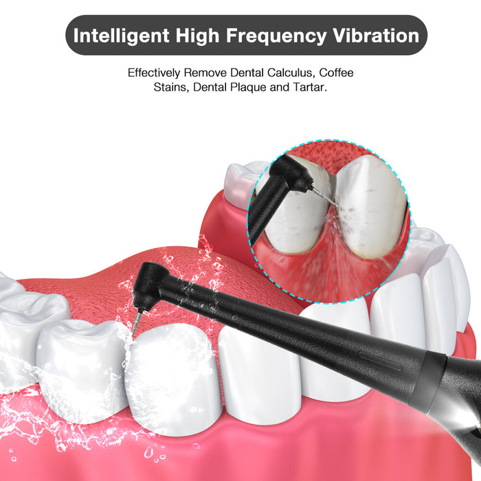 SparkleDent - High-Frequency Dental Cleaner