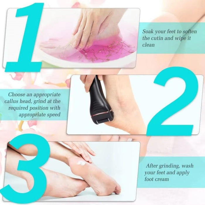 GlowSole - Electric Callus Remover