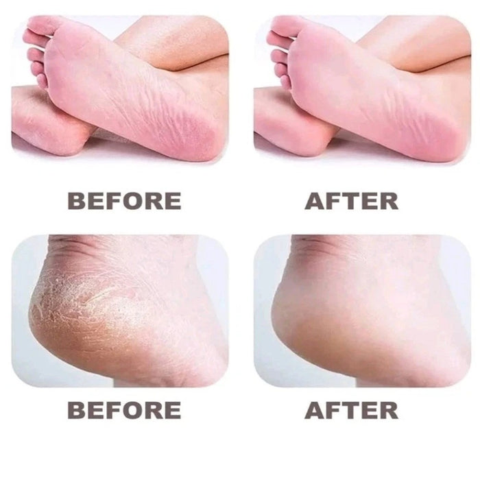 SilkStep – Electric Foot Callus Remover