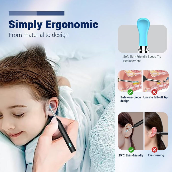 SonicLens - Ear Wax Removal Camera