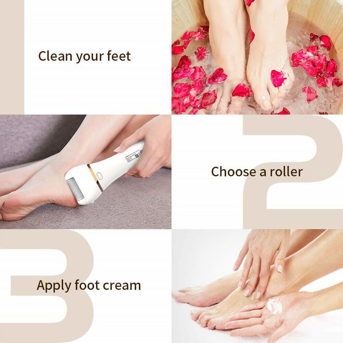 Efficient Electric Callus Remover