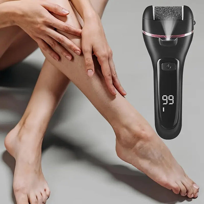 Smoothique - Electric Callus Remover