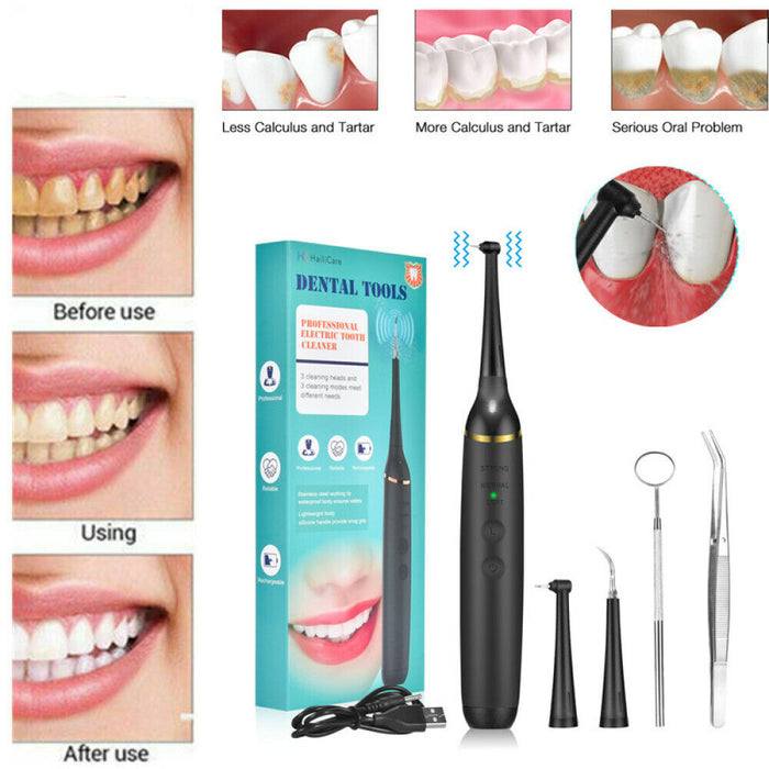 SparkleDent - High-Frequency Dental Cleaner