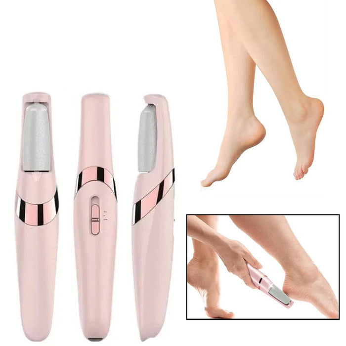 SilkStep – Electric Foot Callus Remover