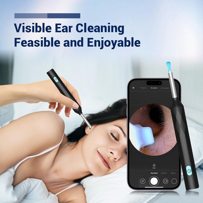 SonicLens - Ear Wax Removal Camera
