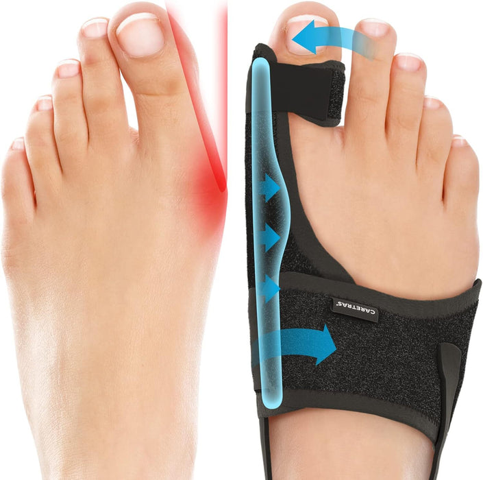 Pedi-Ease Comfort Support - Bunion Corrector for Pain Relief