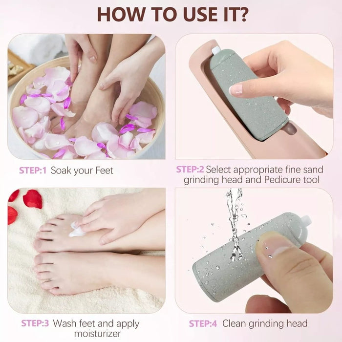 SilkStep – Electric Foot Callus Remover