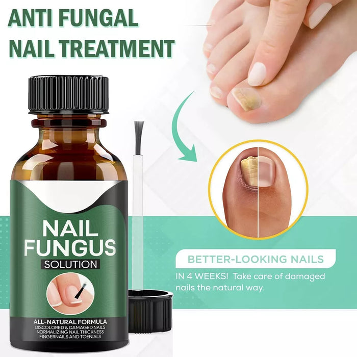 TruNail Naturals- Nail Fungus Treatment