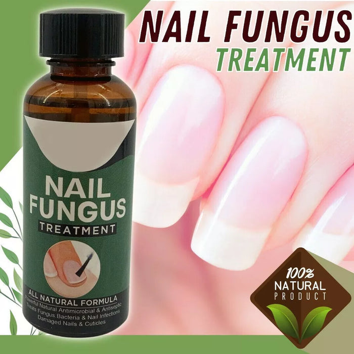 TruNail Naturals- Nail Fungus Treatment