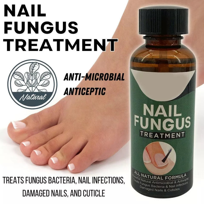 TruNail Naturals- Nail Fungus Treatment